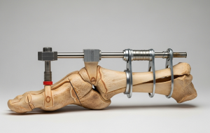 بعضی از آدما از قصد پای خودشون رو زیر تیغ جراحهای زیبایی میبرن تا قدشون بلندتر بشه بعضی از آدما از قصد پای خودشون رو زیر تیغ جراحهای زیبایی میبرن تا قدشون بلندتر بشه