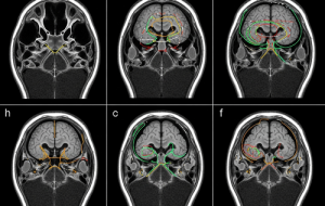 یه نظریه ۵۰ ساله در مورد «صداها»ی اسکیزوفرنی با یه مطالعه جدید تأیید شد یه نظریه ۵۰ ساله در مورد «صداها»ی اسکیزوفرنی با یه مطالعه جدید تأیید شد